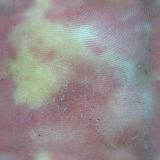 skin040.jpg